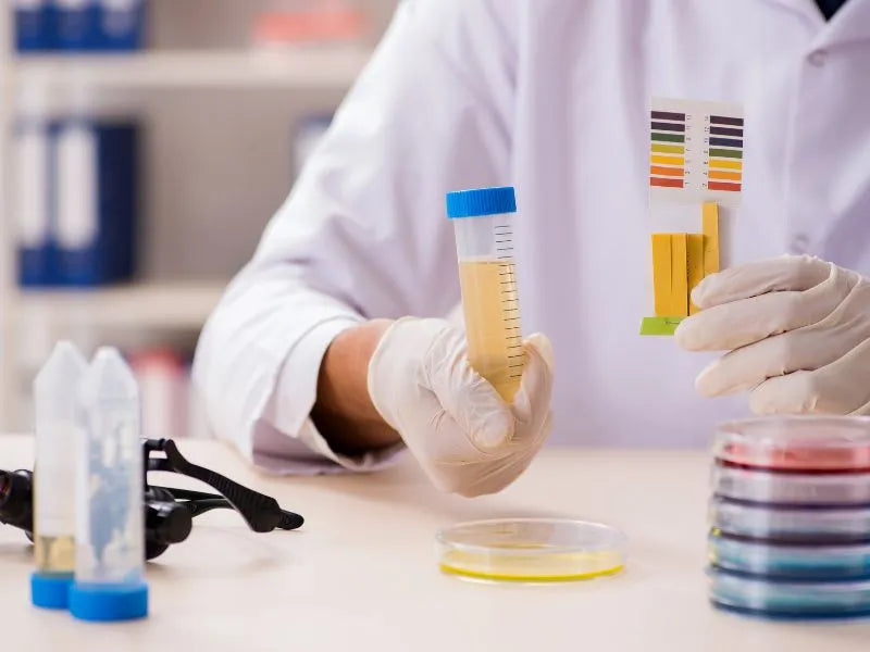 Doctor conducting urine pH test for kidney disease