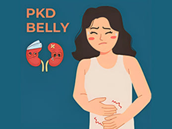 Young woman experiencing kidney pain – a visual representation of the challenges faced by individuals with Polycystic Kidney Disease (PKD).